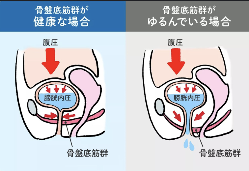 骨盤底筋